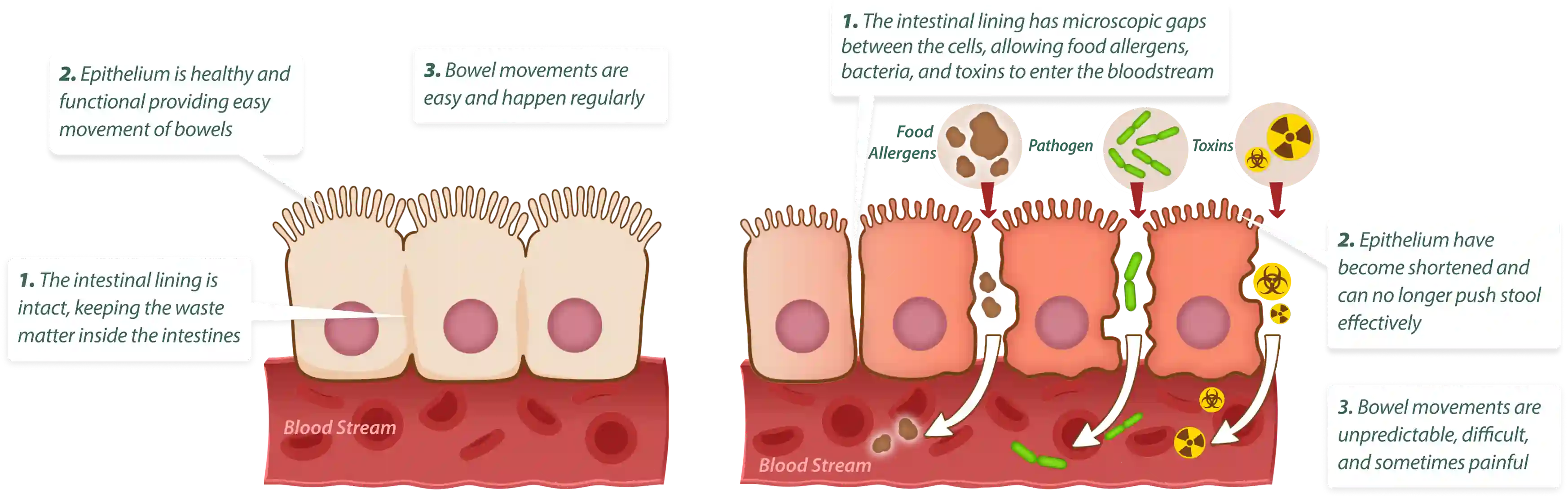 How EmmaRelied works – 3-step gut cleansing and healing process