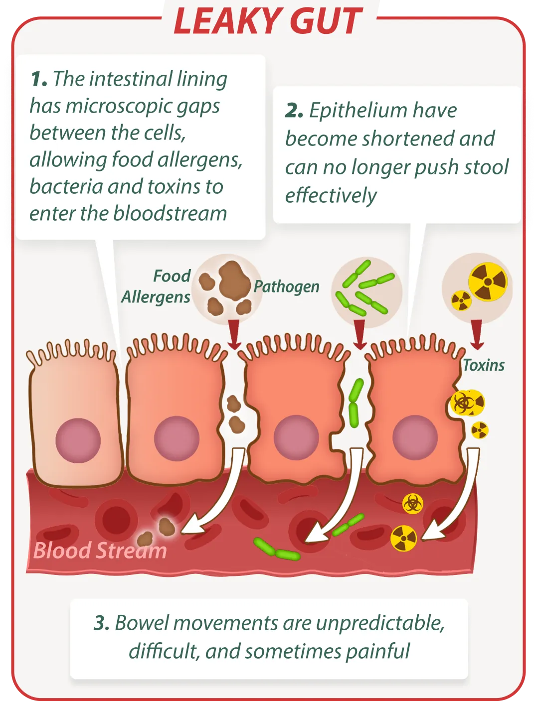 Leaky gut without EmmaRelied – digestive issues illustration